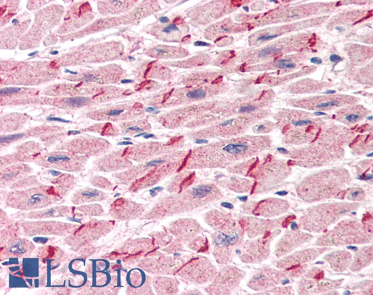 IHC-plus™ JUP/CTNNG/Junction Plakoglobin Antibody (aa732-745)
