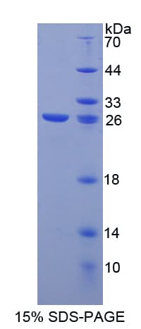 Rat LGALS12 / Galectin 12 Protein (Recombinant His-T7)