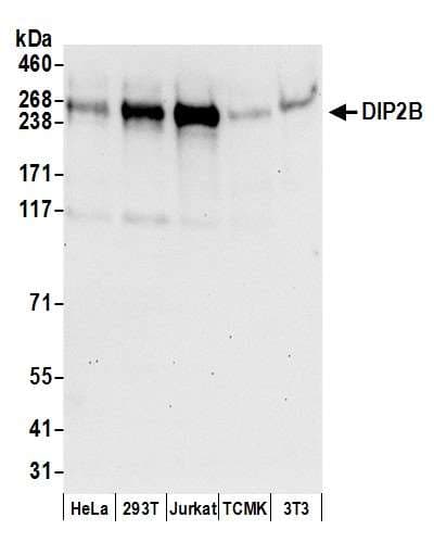 DIP2B Antibody (aa500-550)