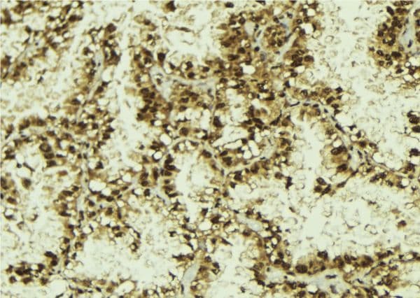 Polyclonal Rabbit anti-Human NUFIP1 / NUFIP Antibody (IHC, WB)