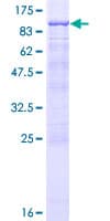 Human RHOT1 Protein (Recombinant GST)