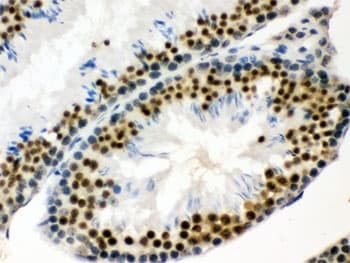 EWSR1 / EWS Antibody