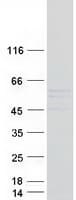Human TTC8 Protein (Recombinant Myc-DDK (Flag))