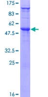 Human SDC4 / Syndecan 4 Protein (Recombinant GST)