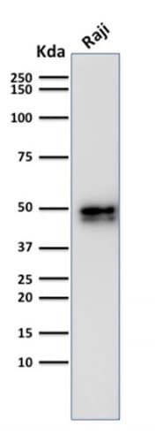 CD79A / CD79 Alpha Antibody (aa202-216, clone IGA/1790R, Azide-free, Carrier-free)