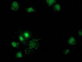 DSTN / Destrin Antibody (clone OTI1D8)