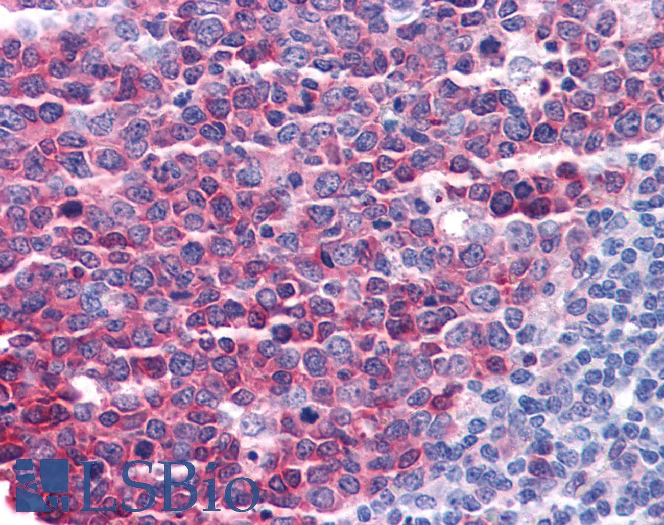 IHC-plus™ Polyclonal Goat anti-Human STMN1 / Stathmin / LAG Antibody (aa135-149, IHC, WB)
