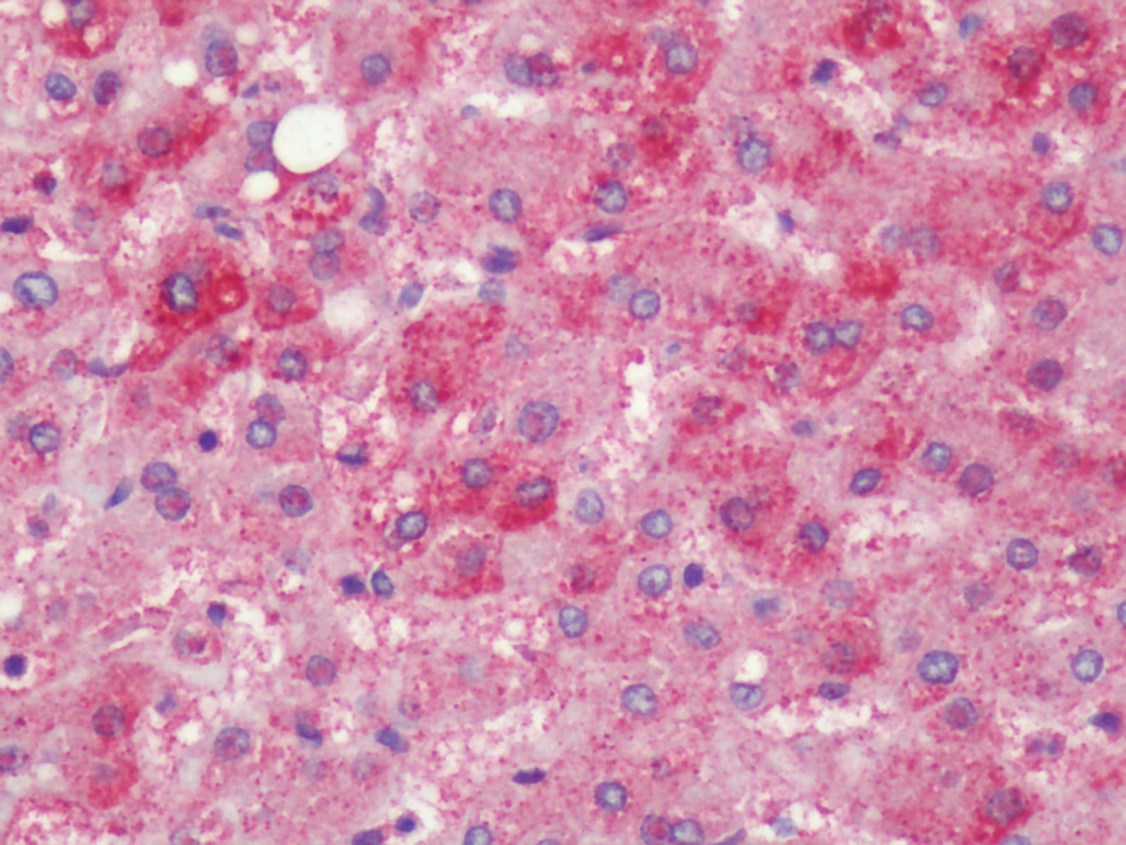 IHC-plus™ Polyclonal Rabbit anti-Human PTGER4 / EP4 Antibody (Extracellular Domain, IHC)