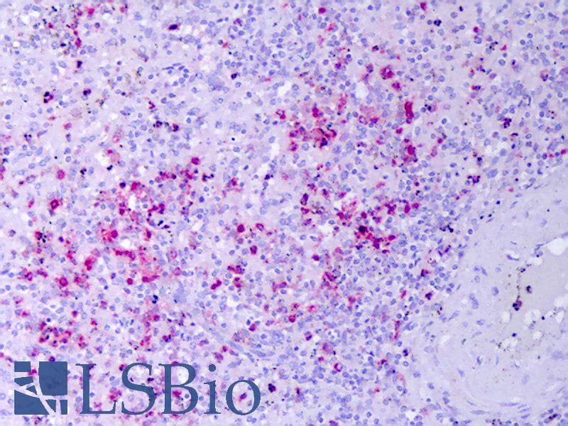 IHC-plus™ Polyclonal Goat anti-Human RETN / Resistin Antibody (IHC, WB)