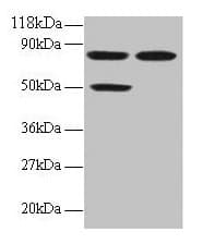 Polyclonal Rabbit anti-Human CCL22 / MDC Antibody (IHC, WB)