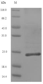 Human Collagen XII Alpha 1 Protein (Recombinant 6His, N-terminus)