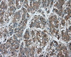 BTK Antibody (clone OTI15G8)