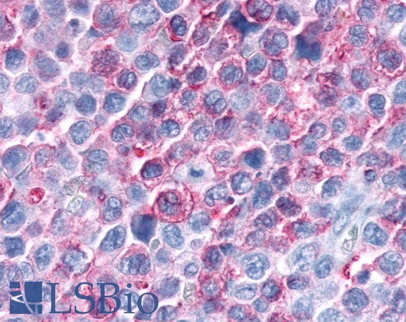 PathPlus™ PKD3 / PRKD3 Antibody (Internal)