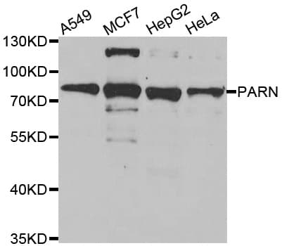 Polyclonal Rabbit anti-Human PARN Antibody (IHC, IF, WB)