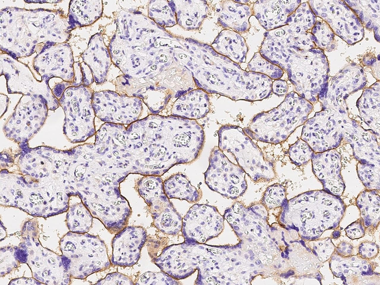 Polyclonal Rabbit anti-Human CD119 / IFNGR1 Antibody (Preservative Free, IHC, WB)