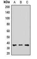 RDH1 / RDH5 Antibody