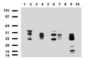 KRT8 / CK8 / Cytokeratin 8 Antibody (aa91-381, clone UMAB1, Carrier-free)