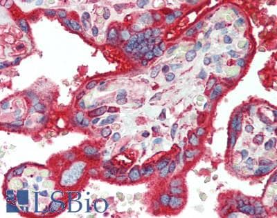 IHC-plus™ PDI / P4HB Antibody