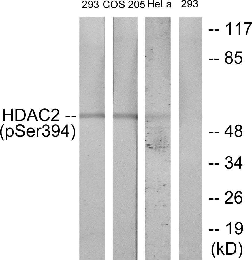 Polyclonal Rabbit anti-Human HDAC2 Antibody (phospho-Ser394, WB)