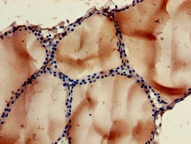 NOB1 / NOB1P Antibody
