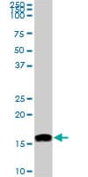 NME2 Antibody (clone 1D3)