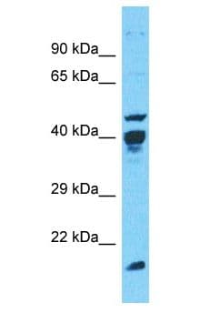 Polyclonal Rabbit anti-Human POLR1C / RPA39 Antibody (aa21-70, WB)