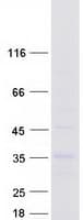 Human SLC7A8 / LAT2 Protein (Recombinant Myc-DDK (Flag))