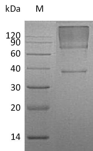 Human GPC3 / Glypican 3 Protein (Recombinant 6His, C-terminus)
