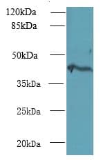 Polyclonal Rabbit anti-Human NME7 Antibody (aa1-150, IHC, WB)