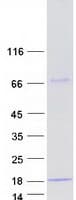 Human YPEL5 Protein (Recombinant Myc-DDK (Flag))