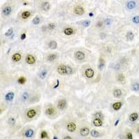 FACT / SSRP1 Antibody