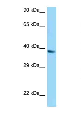 UCP1 / UCP-1 Antibody (C-Terminus)