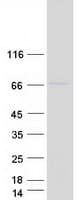 Human ENTPD7 Protein (Recombinant Myc-DDK (Flag))