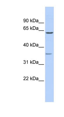 Polyclonal Rabbit anti-Human GBAS Antibody (aa179-228, WB)