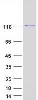 Human ADAMTS3 Protein (Recombinant Myc-DDK (Flag))