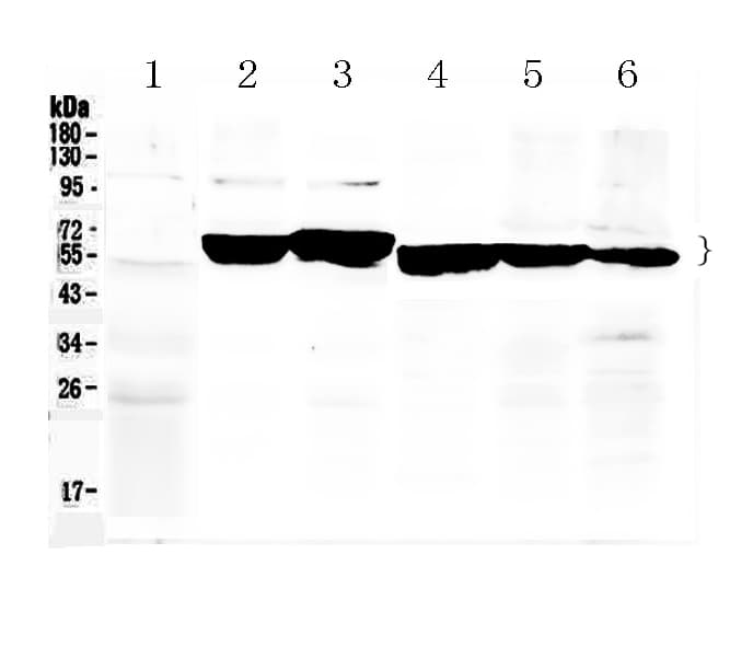 KRT8 / CK8 / Cytokeratin 8 Antibody