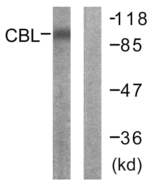 Polyclonal Rabbit anti-Human c-CBL Antibody (aa666-715, IHC, IF, WB)
