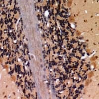 CLDN4 / Claudin 4 Antibody