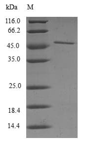 Human RANBP2 / TRP1 Protein (Recombinant 6His-B2M, N-terminus)