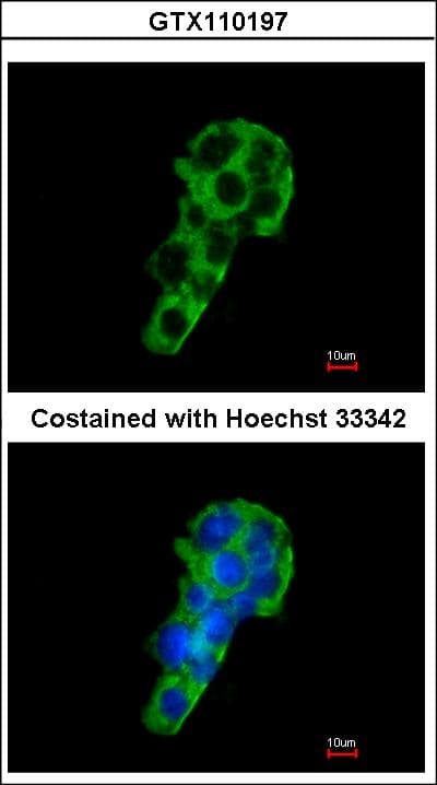 Polyclonal Rabbit anti-Human PIGR Antibody (aa180-459, IHC, WB)