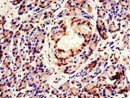 Polyclonal Rabbit anti-Human CPSF6 Antibody (IHC, IF, WB)