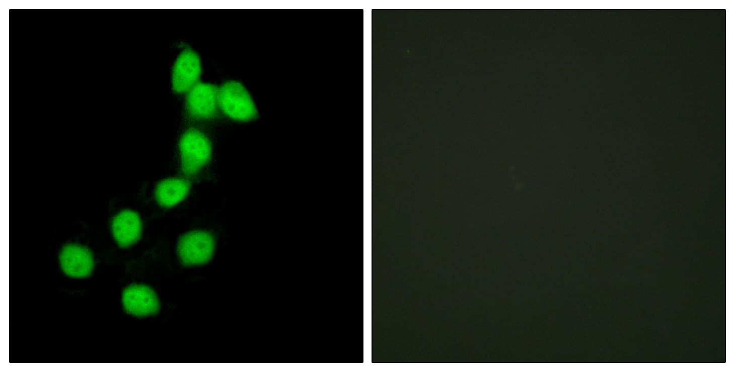 Polyclonal Rabbit anti-Human DYRK / DYRK1A Antibody (aa21-70, IF, WB)