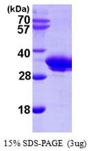 Human SMNDC1 Protein (Recombinant 6His, N-terminus)