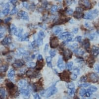 p56lck / LCK Antibody (phospho-Tyr505)