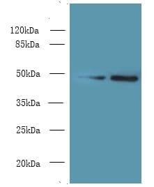 MRPS5 Antibody