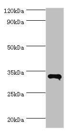 RNF212 Antibody (aa1-297)