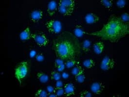 PECR Antibody (clone OTI1E4)