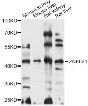 ZNF621 Antibody