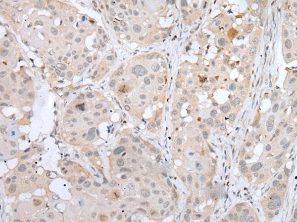 MEF2B Antibody