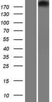 Human TJP1 / ZO-1 Protein (Over-Expression Lysate Myc-DDK (Flag))